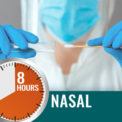 Nasal Swab RT-PCR Test