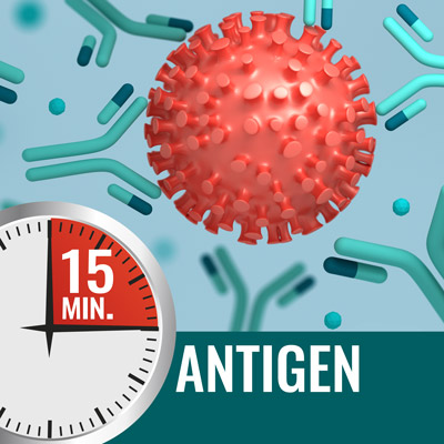 Rapid-Antigen-Test