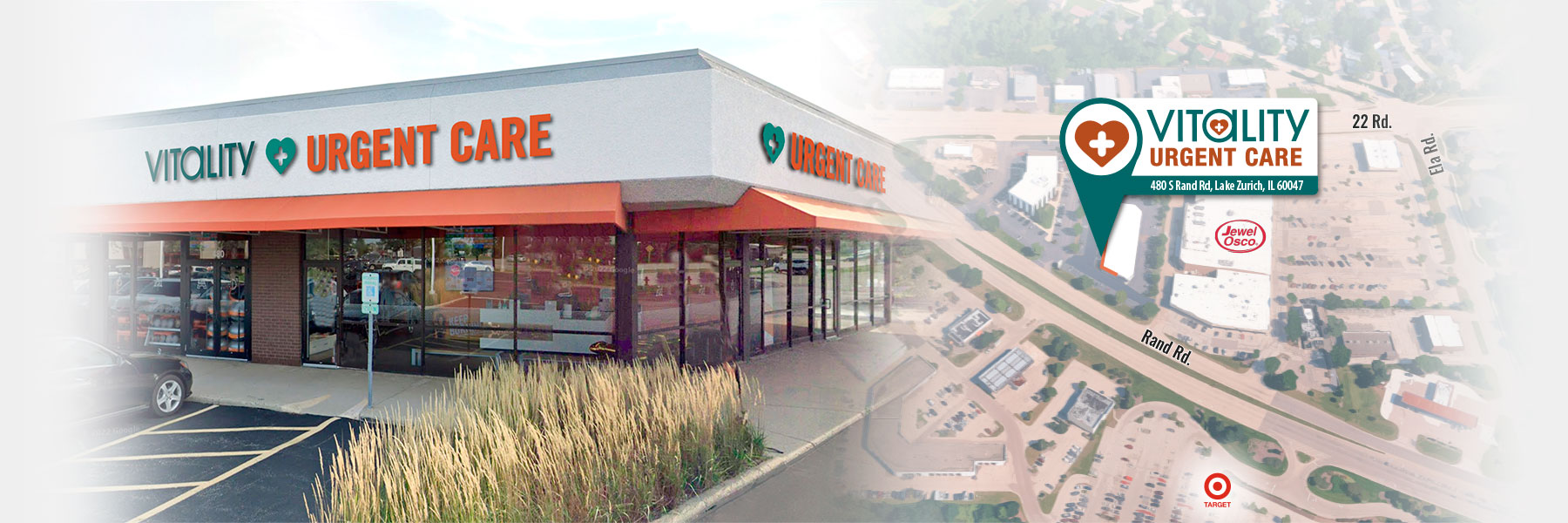 X-Ray Radiology Service - Vitality Urgent Care, Walk-In Clinic ... Urgent care near me with x ray