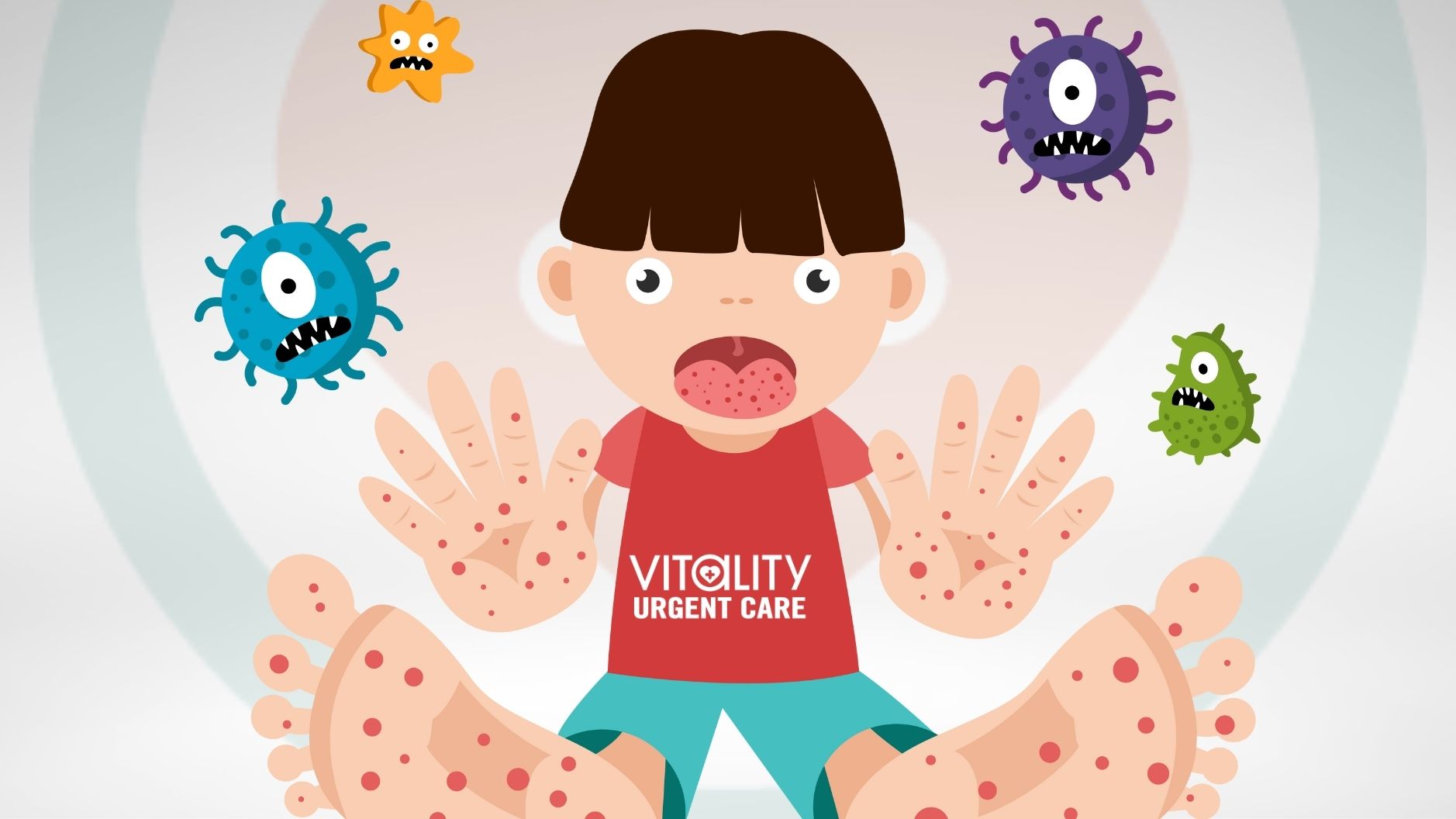 Child illustration showing hand, foot, and mouth disease with rash and mouth sores.