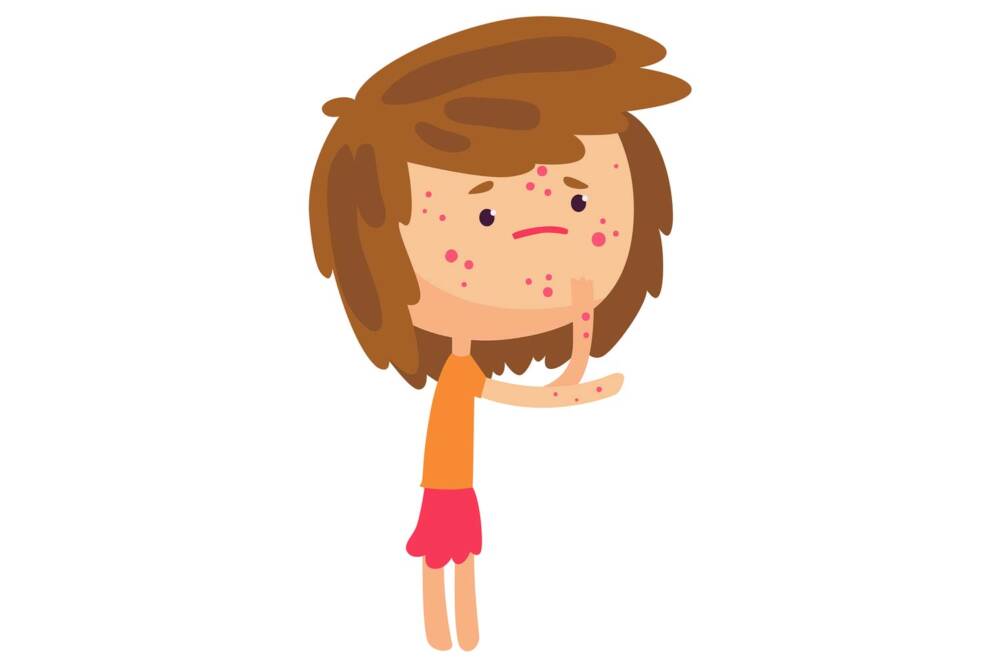 Rash-in-a-child