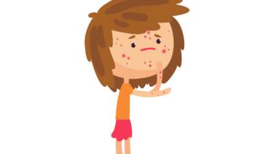 Rash-in-a-child
