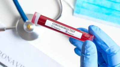 COVID-19 Test